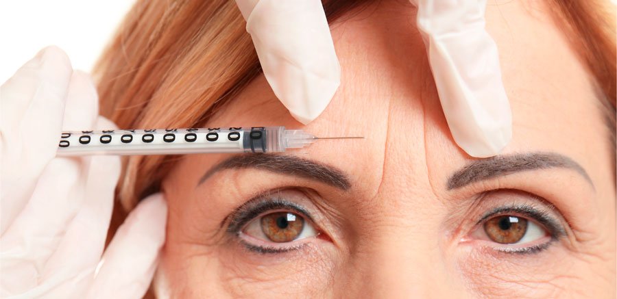 Imagen de la aplicación de sustancias neuromoduladoras para disminuir las arrugas de expresión en la frente.