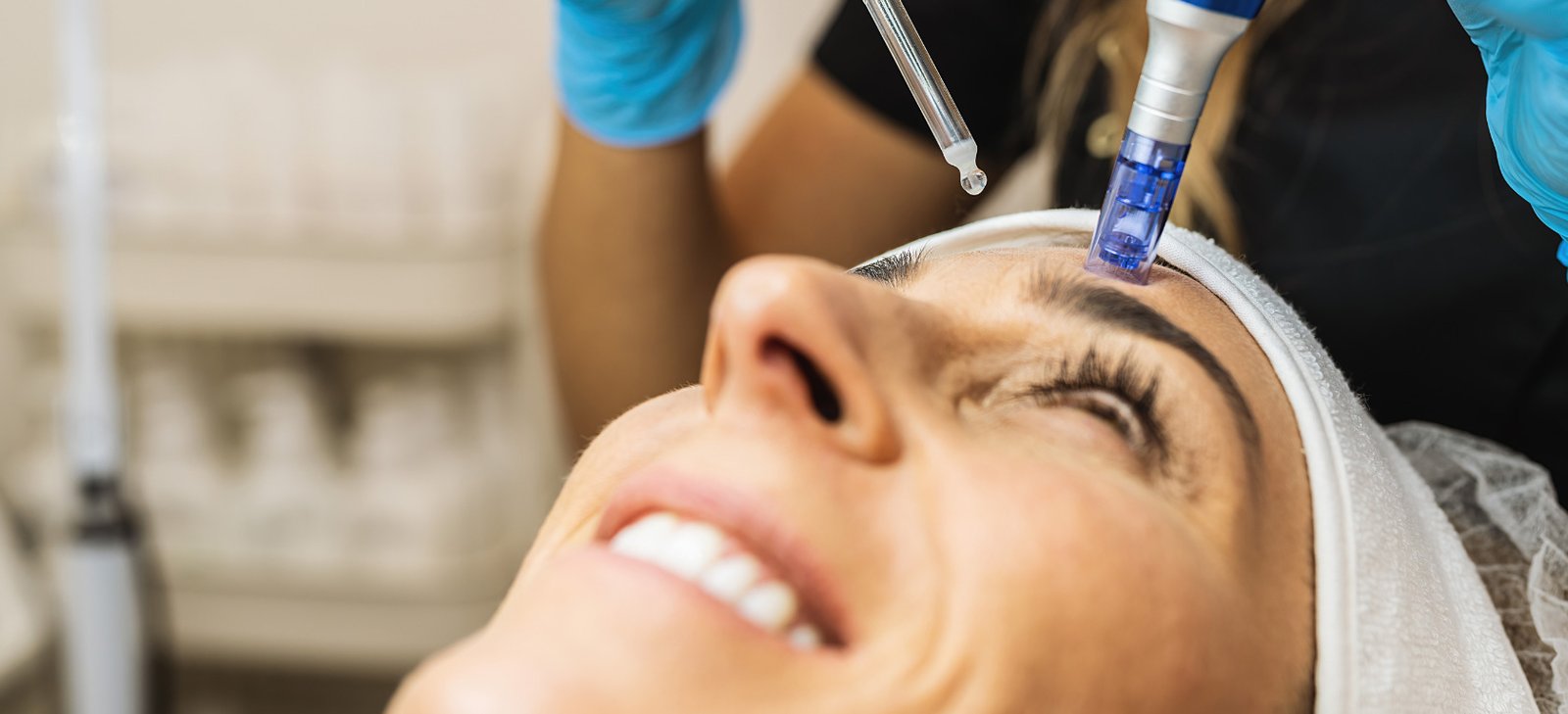 Imagen de un tratamiento con dermapen.